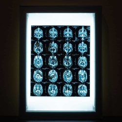 Acroe Brain Scan 1/3