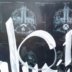 Acroe Brain Scan 1/3