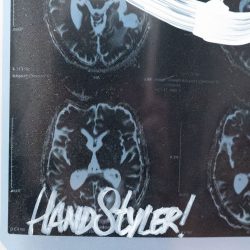 Acroe Brain Scan 1/3