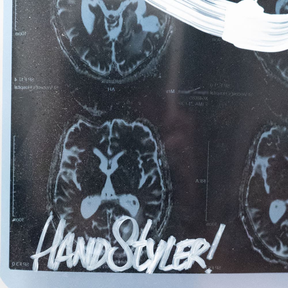 Acroe Brain Scan 1/3